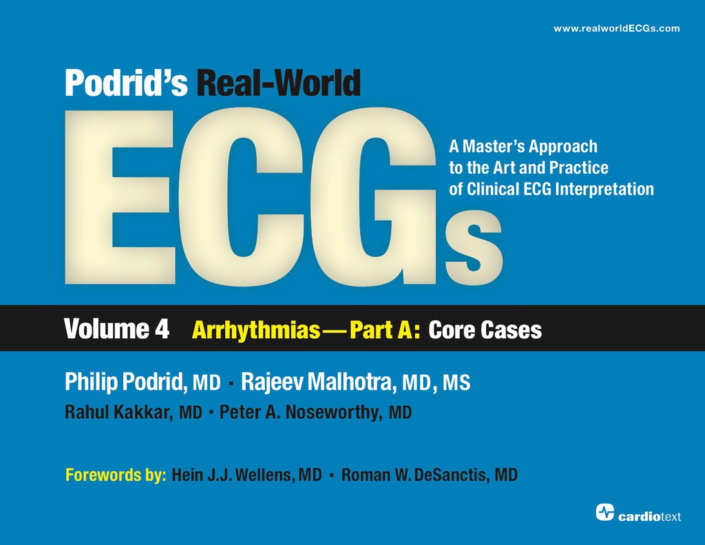 Podrid's Real-World ECGs: Volume 4A, Arrhythmias [Core Cases] 1st Edition â€“ PDF/EPUB Version Downloadable